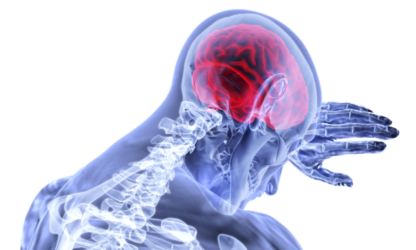 السكتة الدماغية: الأعراض والأسباب